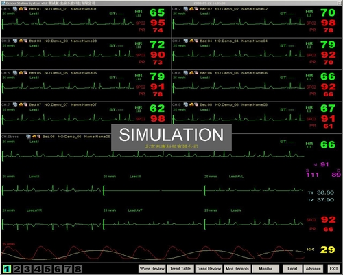 central monitoring system of Portable bedside Patient Monitor